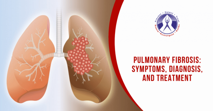 Pulmonary fibrosis symptoms